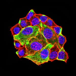 Figure 5:Immunofluorescence analysis of Hela cells using ATG3 mouse mAb (green). Blue: DRAQ5 fluorescent DNA dye. Red: Actin filaments have been labeled with Alexa Fluor- 555 phalloidin. Secondary antibody from Fisher (Cat#: 35503)