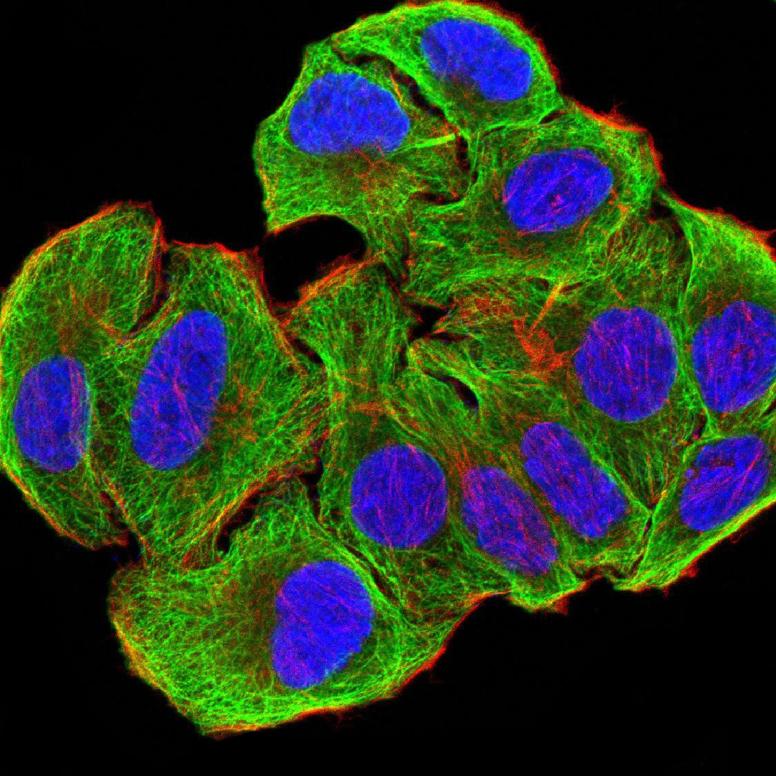 Figure 6:Immunofluorescence analysis of SMMC-7721 cells using ATG3 mouse mAb (green). Blue: DRAQ5 fluorescent DNA dye. Red: Actin filaments have been labeled with Alexa Fluor- 555 phalloidin. Secondary antibody from Fisher (Cat#: 35503)