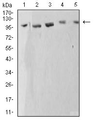 Figure 4:Western blot analysis using ATP2A1 mouse mAb against C2C12 (1), COS7 (2), Hela (3), K562 (4), and Jurkat (5) cell lysate.