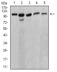 Figure 4:Western blot analysis using ATP2A1 mouse mAb against C2C12 (1), COS7 (2), Hela (3), K562 (4), and Jurkat (5) cell lysate.
