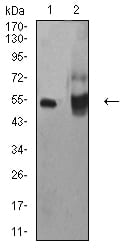 Figure 4:Western blot analysis using ALDH1A1 mouse mAb against HepG2 (1) and A549 (2) cell lysate.