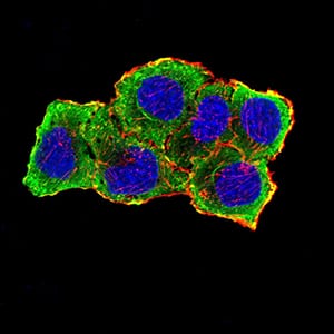 Figure 6:Immunofluorescence analysis of SMMC-7721 cells using AURKA mouse mAb (green). Blue: DRAQ5 fluorescent DNA dye. Red: Actin filaments have been labeled with Alexa Fluor- 555 phalloidin. Secondary antibody from Fisher (Cat#: 35503)