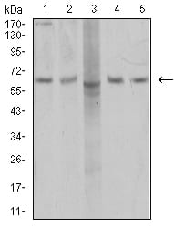 Figure 4:Western blot analysis using AP2M1 mouse mAb against COS7 (1), SK-Br-3 (2), MCF-7 (3), T47D (4), and HEK293 (5) cell lysate.