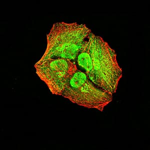 Figure 5:Immunofluorescence analysis of Hela cells using ACVR1 mouse mAb (green). Blue: DRAQ5 fluorescent DNA dye. Red: Actin filaments have been labeled with Alexa Fluor- 555 phalloidin. Secondary antibody from Fisher (Cat#: 35503)