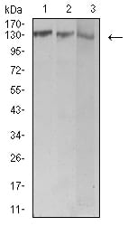 Figure 4:Western blot analysis using BCR mouse mAb against Jurkat (1), Hela (2), and Ramos (3) cell lysate.