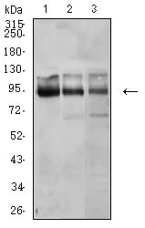 Figure 4:Western blot analysis using CTNNB1 mouse mAb against A431 (1), U251 (2), and HEK293 (3) cell lysate.