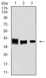 Figure 4:Western blot analysis using ALDOA mouse mAb against MCF-7 (1), Hela (2), and NIH/3T3 (3) cell lysate.