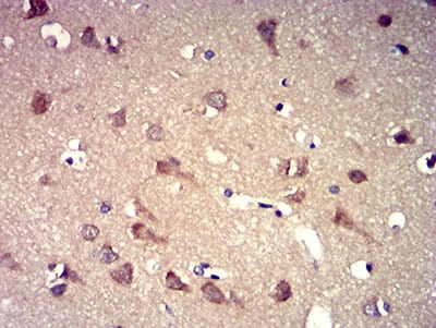 Figure 7:Immunohistochemical analysis of paraffin-embedded brain tissues using P2RY8 mouse mAb with DAB staining.