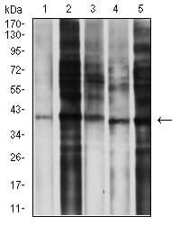 Figure 4:Western blot analysis using CD195 mouse mAb against MOLT4 (1), L-02 (2), SPA-C-1 (3), A549 (4), and C6 (5) cell lysate.