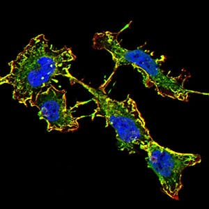 Figure 5:Immunofluorescence analysis of SK-N-SH cells using GRIN2B mouse mAb (green). Blue: DRAQ5 fluorescent DNA dye. Red: Actin filaments have been labeled with Alexa Fluor- 555 phalloidin. Secondary antibody from Fisher (Cat#: 35503)