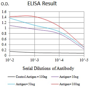 Figure 1: Black line: Control Antigen (100 ng);Purple line: Antigen (10ng); Blue line: Antigen (50 ng); Red line:Antigen (100 ng)