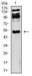 Figure 4:Western blot analysis using CD119 mouse mAb against HepG2 (1) cell lysate.