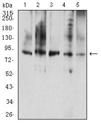 Figure 4:Western blot analysis using CD114 mouse mAb against A431 (1), K562 (2), THP-1 (3), MOLT4 (4), and Jurkat (5) cell lysate.