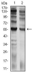 Figure 4:Western blot analysis using CD129 mouse mAb against C6 (1) and PC-3 (2) cell lysate.