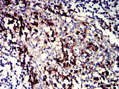 Figure 5:Immunohistochemical analysis of paraffin-embedded tonsil tissues using CD319 mouse mAb with DAB staining.