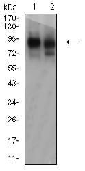 Figure 4:Western blot analysis using CD44 mouse mAb against HUVEC (1) and HUVE-12 (2) cell lysate.