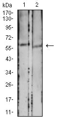 Figure 4:Western blot analysis using CD39 mouse mAb against HCT116 (1) and LOVO (2) cell lysate.