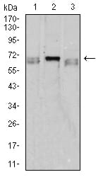 Figure 4:Western blot analysis using CD42B mouse mAb against K562 (1), HL-60 (2), and Ramos (3) cell lysate.