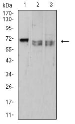 Figure 4:Western blot analysis using CD42B mouse mAb against HL-60 (1), MOLT4 (2), and Ramos (3) cell lysate.