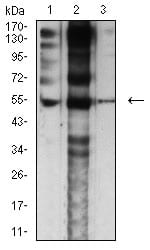 Figure 4:Western blot analysis using CHRNE mouse mAb against Jurkat (1), C6 (2), and SK-N-SH (2) cell lysate.