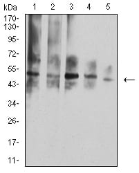 Figure 4:Western blot analysis using TNFRSF10D mouse mAb against Hela (1), L-02 (2), A549 (3), HepG2 (4), and COS7 (5) cell lysate.