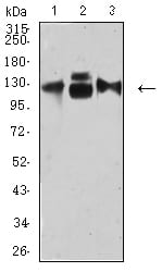 Figure 4:Western blot analysis using CD49C mouse mAb against HepG2 (1), HUVEC (2), and HUVE-12 (3) cell lysate.