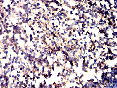 Figure 6:Immunohistochemical analysis of paraffin-embedded tonsil tissues using CD11a mouse mAb with DAB staining.