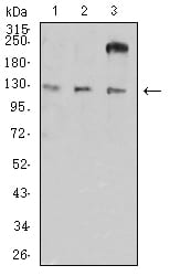 Figure 4:Western blot analysis using CD11a mouse mAb against HL-60 (1), A549 (2), and SW620 (3) cell lysate.