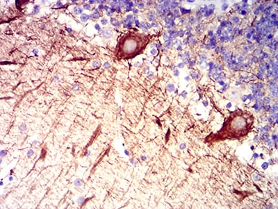 Figure 5:Immunohistochemical analysis of paraffin-embedded cerebellum tissues using RAB27B mouse mAb with DAB staining.