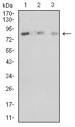 Figure 4:Western blot analysis using CD18 mouse mAb against HL-60 (1), Jurkat (2), and MOLT4 (3) cell lysate.