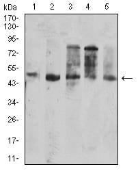 Figure 4:Western blot analysis using CD177 mouse mAb against SPC-A-1 (1), SK-MES-1 (2), HepG2 (3), HL-60 (4), and PC-3 (5) cell lysate.