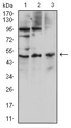 Figure 4:Western blot analysis using CD127 mouse mAb against Hela (1), HL-60 (2), and U937 (3) cell lysate.