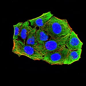 Figure 4:Immunofluorescence analysis of Hela cells using CD156 mouse mAb (green). Blue: DRAQ5 fluorescent DNA dye. Red: Actin filaments have been labeled with Alexa Fluor- 555 phalloidin. Secondary antibody from Fisher (Cat#: 35503)