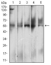 Figure 4:Western blot analysis using CD299 mouse mAb against L-02 (1), HepG2 (2), BEL-7402 (3), SMMC-7702 (4), and HL-7702 (5) cell lysate.