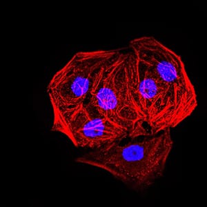 Figure 4:Immunofluorescence analysis of Hela cells. Blue: DRAQ5 fluorescent DNA dye. Red: Actin filaments have been labeled with Alexa Fluor- 555 phalloidin.