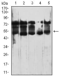 Figure 4:Western blot analysis using CD364 mouse mAb against THP-1 (1), PC-3 (2), LNCAP (3), Jurkat (4), and A431 (5) cell lysate.