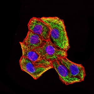 Figure 8:Immunofluorescence analysis of Hela cells using KRT18 mouse mAb (green). Blue: DRAQ5 fluorescent DNA dye. Red: Actin filaments have been labeled with Alexa Fluor- 555 phalloidin. Secondary antibody from Fisher (Cat#: 35503)