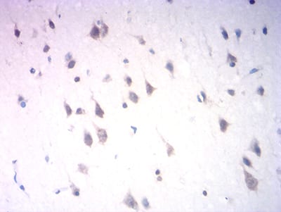 Figure 6:Immunohistochemical analysis of paraffin-embedded human brain tissues using Neurod mouse mAb with DAB staining.