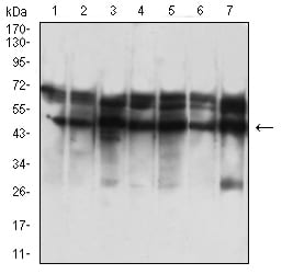 Figure 4:Western blot analysis using KRT18 mouse mAb against SK-BR-3 (1), HepG2 (2), T47D (3), MCF-7 (4), Hela (5), A431 (6), and HCT116 (7) cell lysate.