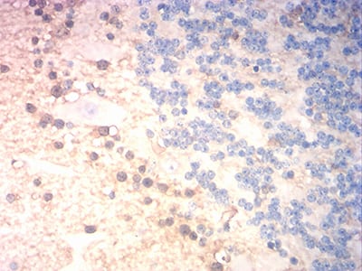 Figure 5:Immunohistochemical analysis of paraffin-embedded cerebellum tissues using S100B mouse mAb with DAB staining.