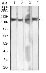 Figure 4:Western blot analysis using MSH6 mouse mAb against MIH/3T3 (1), A431 (2), K562 (3), and COS7 (4) cell lysate.