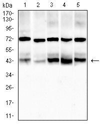 Figure 4:Western blot analysis using ACADM mouse mAb against Hela (1), HepG2 (2),Jurkat (3),Raji (4) and K562 (5) cell lysate.