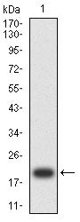 Figure 2:Western blot analysis using ACADM mAb against human ACADM (AA: 26-185) recombinant protein. (Expected MW is 20.5kDa)