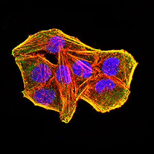 Figure 4:Immunofluorescence analysis of Hela cells using KLK2 mouse mAb (green). Blue: DRAQ5 fluorescent DNA dye. Red: Actin filaments have been labeled with Alexa Fluor- 555 phalloidin. Secondary antibody from Fisher (Cat#: 35503)