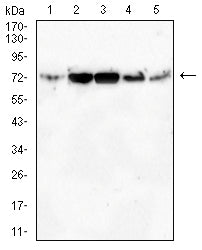 Figure 3:Western blot analysis using NDC80 mouse mAb against Hela (1), HepG2 (2), Jurkat (3), K562 (4) and A431 (5) cell lysate.