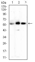 Figure 4:Western blot analysis using TNFRSF11A mouse mAb against Rat brain (1), Mouse kindey (2), and Rat kindey (3) cell lysate.