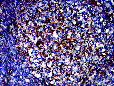 Figure 4:Immunohistochemical analysis of paraffin-embedded tonsil tissues using TMEM119 mouse mAb with DAB staining.