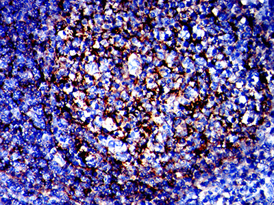 Figure 5:Immunohistochemical analysis of paraffin-embedded tonsil tissues using TMEM119 mouse mAb with DAB staining.
