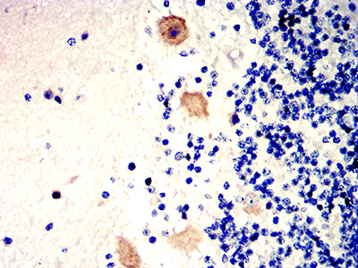 Figure 7:Immunohistochemical analysis of paraffin-embedded cerebellum tissues using CD157 mouse mAb with DAB staining.