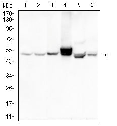 Figure 3:Western blot analysis using KRT14 mouse mAb against MCF-7 (1), Hela (2), A431 (3), SW480 (4), T47D (5) and Molt-4 (6) cell lysate.